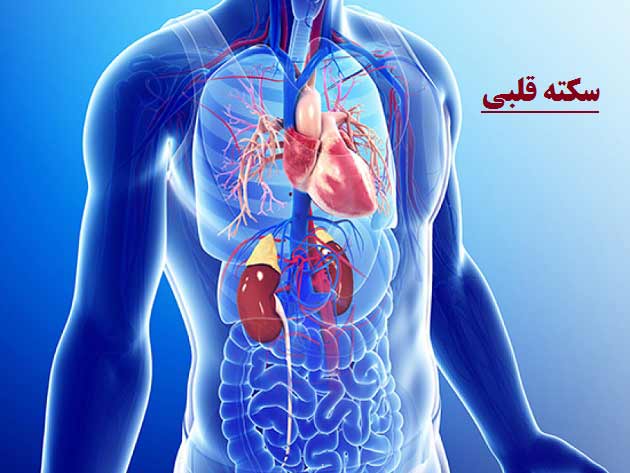 علت بیماری سکته قلبی + علاوم، درمان، تشخیص و سبک زندگی مناسب