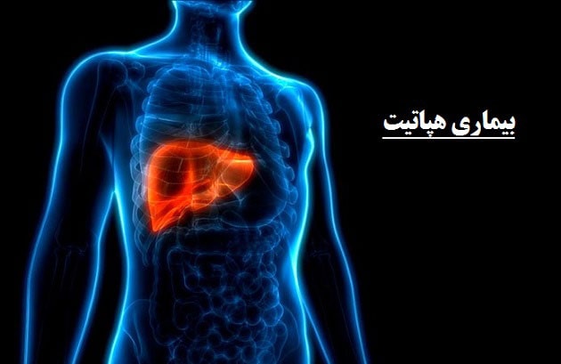 بیماری هپاتیت