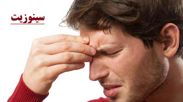 بیماری سینوزیت