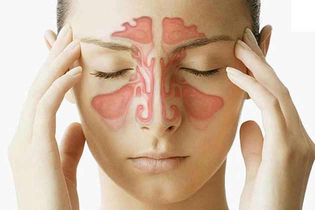 علت بیماری سینوزیت + علائم، نشانه ها، درمان و سبک زندگی مناسب