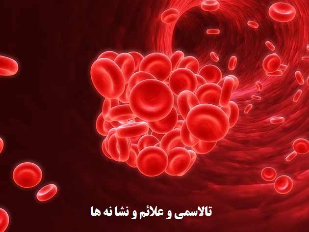 بیماری تالاسمی